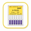 Composite filling