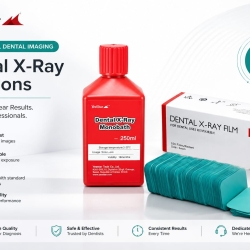 Dental X-Ray Film &amp; Dental X-Ray Monobath